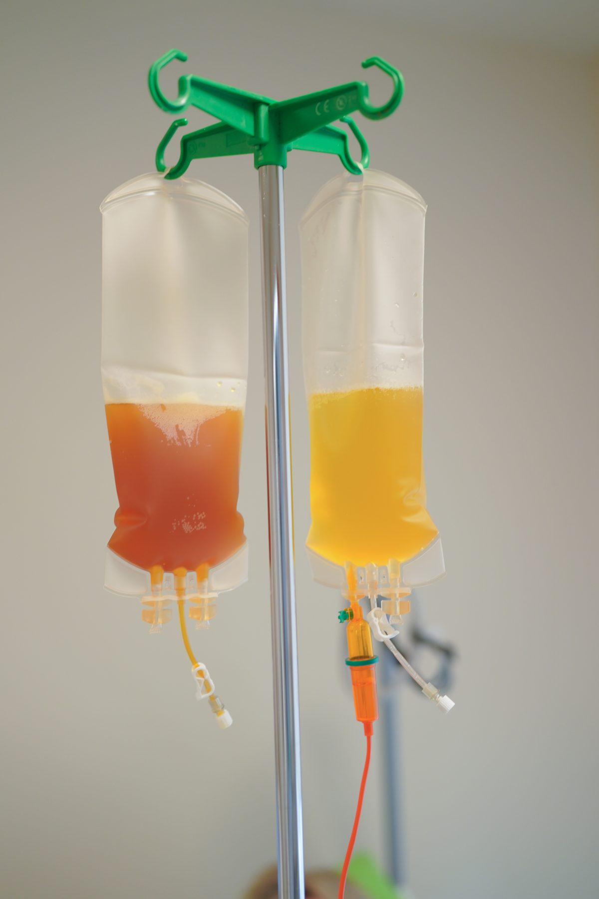 VitaPherese® Plasma Optimization — Galerie — 2